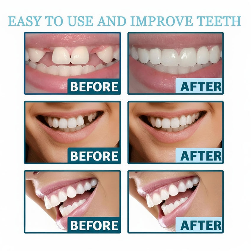 Snap in Teeth for Men and Women