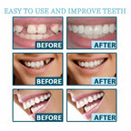 Snap in Teeth for Men and Women