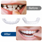 Snap in Teeth for Men and Women